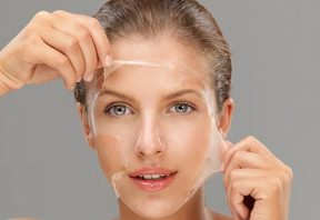 لایهبرداری شیمیایی